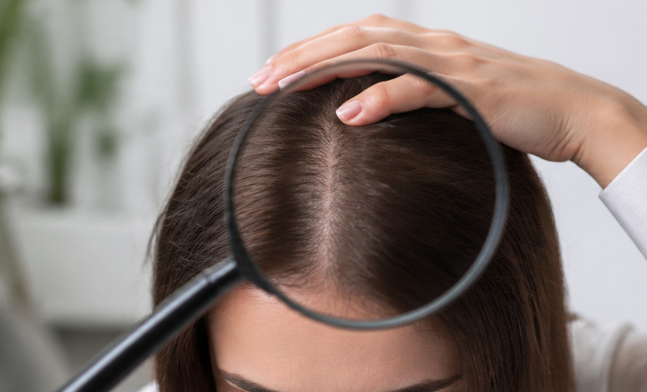 Hair falling causes illustration